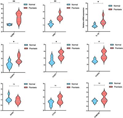 Classification and biomarker gene selection of pyroptosis-related gene expression in psoriasis using a random forest algorithm